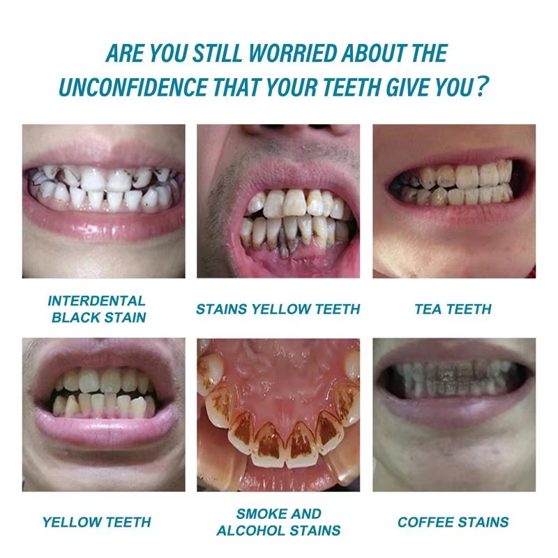 Teeth Whitening Essence Remove - огляд і ціна Teeth Whitening Serum