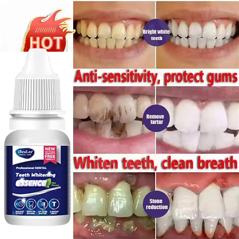 Teeth Whitening Essence Remove - огляд і ціна Teeth Whitening Serum
