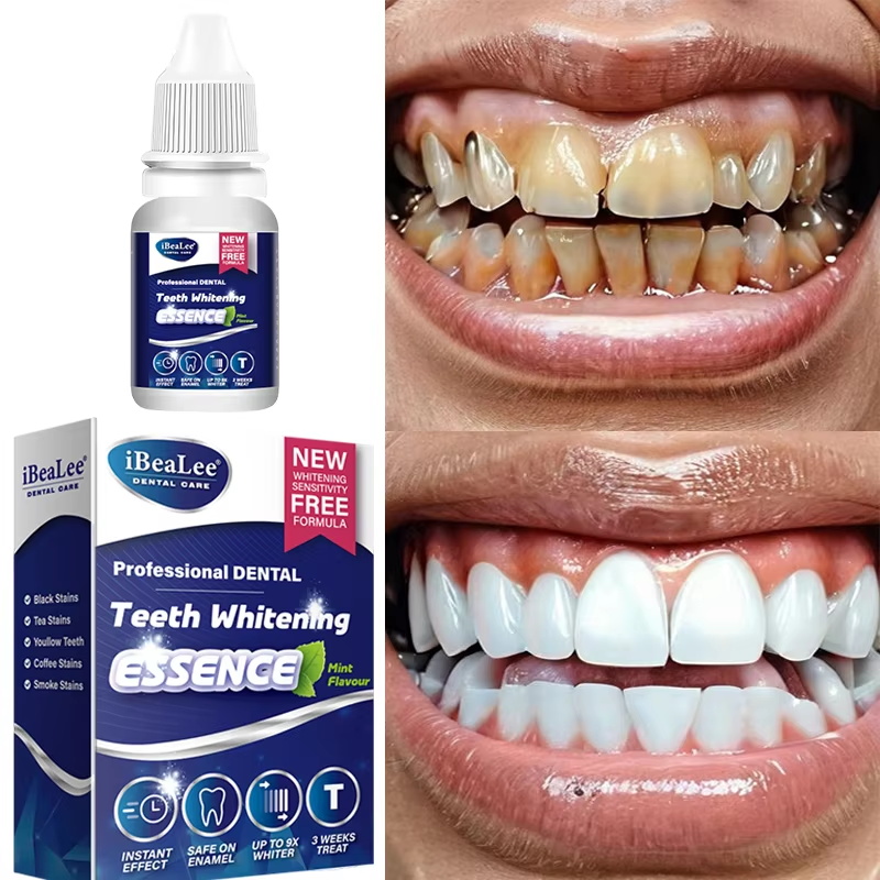 Teeth Whitening Essence Remove - огляд і ціна Teeth Whitening Serum
